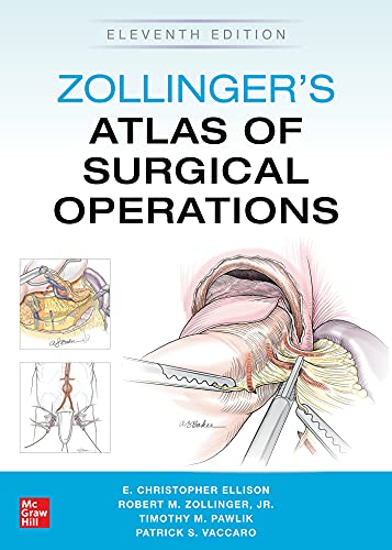 Zollingerâ€™s Atlas of Surgical Operations, Eleventh Edition (True PDF) - download pdf